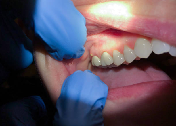 Best Emergency Broken Tooth Repair in West Easton, PA