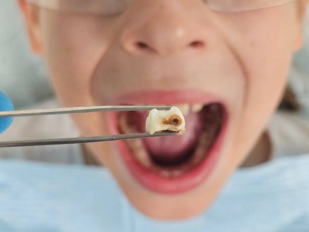 Best Emergency Treatment for Toothache in West Easton, PA